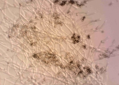 mycelium s výtrusy houby vypěstované na agaru 