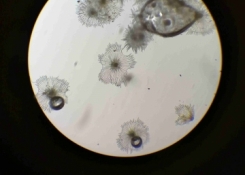 trichomy hlošiny